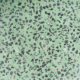 terrazzo-vert-arborescence-sud-ouest