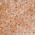terrazzo gris et marron